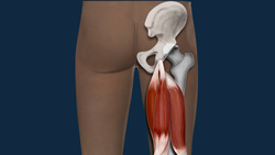 Hamstring injury