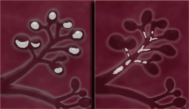 LEFT: Lobular calcifications: punctate, round or 'milk of calcium' RIGHT: Intraductal calcifications: pleomorph and form casts in a linear or branching distribution.