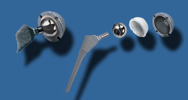 LEFT: Assembled cementless Mallory Head prosthesis.RIGHT: Femoral stem with proximal porous coating for bone ingrowth, separate metal femoral head, polyethylene acetabular liner with a porous coated metal backing.