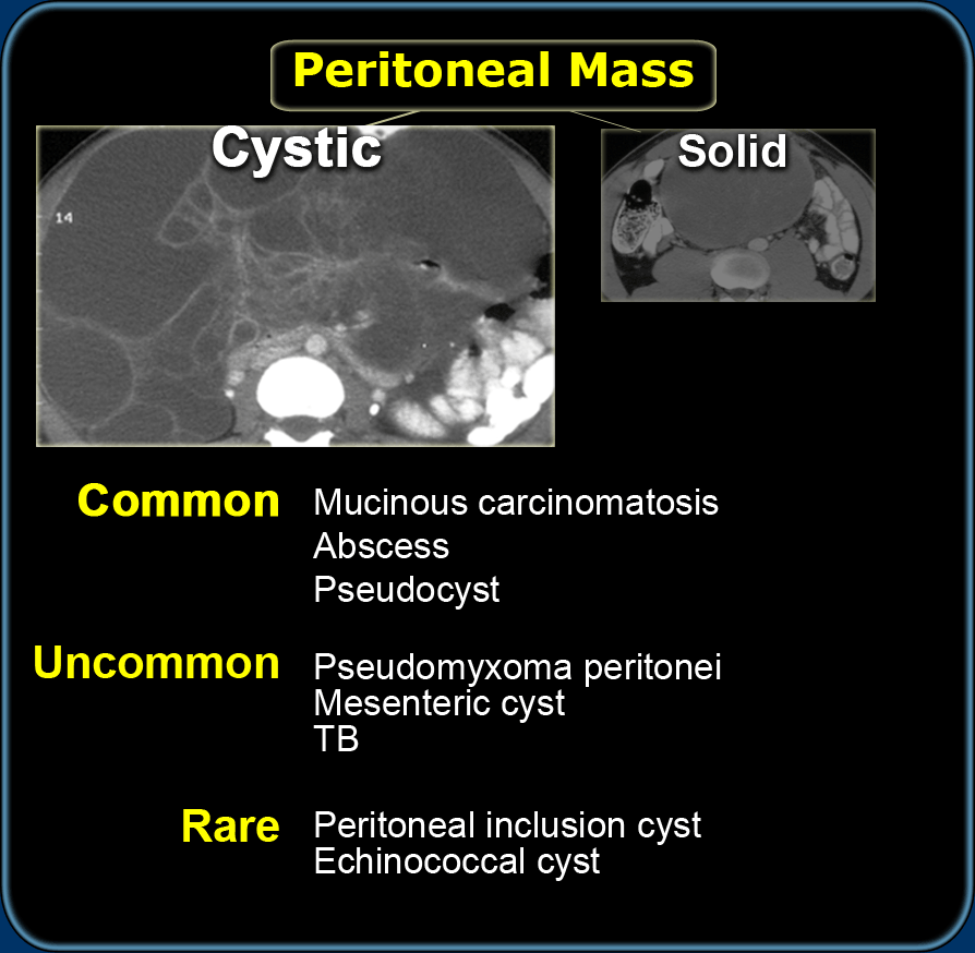 Differential diagnosis of cystic peritoneal masses