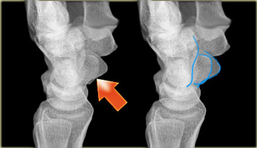 True lateral: The palmar cortex of pisiform (red arrow) lies between the palmar cortex of scaphoid and capitate.